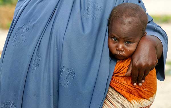 عکسای بسیار نارحت کننده و تکون دهنده از کودکان معصوم سومالی