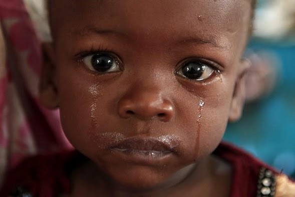 عکسای بسیار نارحت کننده و تکون دهنده از کودکان معصوم سومالی